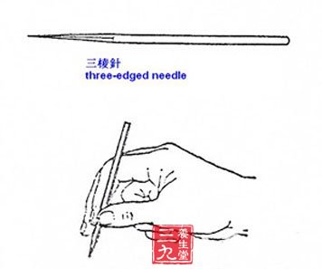 夏季易中暑试试中医刮痧