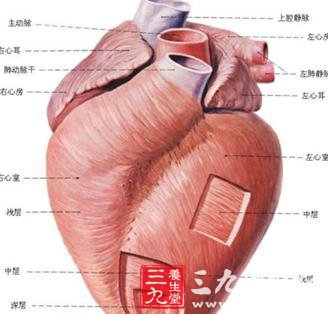 心室间隔穿破