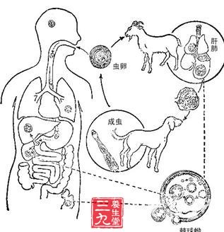 脑包虫病