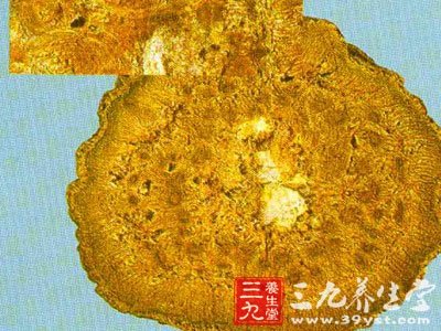 急性黄疸型肝炎的偏方2