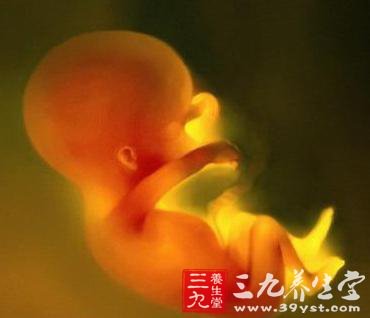 特发性羊水过多