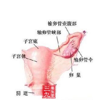 盆腔淤血综合征