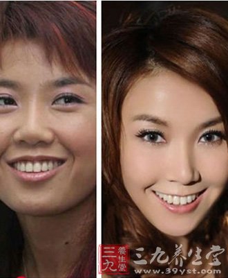 明星整容抄报后遗症内容|明星整容抄报后遗症版面 ...