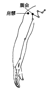 小儿麻痹后遗症的刮痧疗法