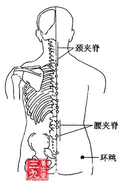 小儿麻痹后遗症的刮痧疗法
