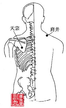 乳腺增生的刮痧疗法
