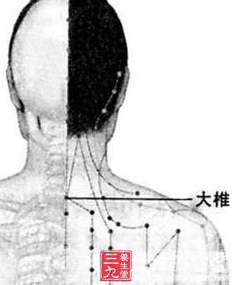 大椎位于第七颈椎棘突下 刺激这个穴位治疗瘀血脉络