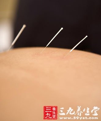 艾灸养生 中医馆女人新选择