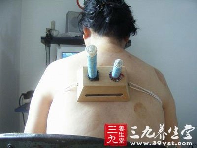 艾灸盒的使用方法及特点(2)