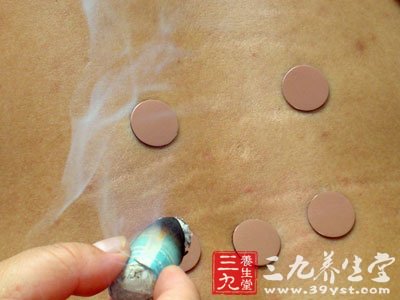 艾灸疗法治疗儿童过敏性鼻炎