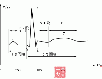 ③qrs波:心室除极波,第一个向下波称q波,第一个向上波称r波,完全向下
