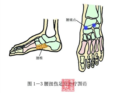 腰椎,腰痛点反射区位置