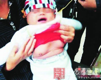 河南4岁<em>女童</em>患性<em>早熟</em> 儿童性<em>早熟</em>是什么-三九