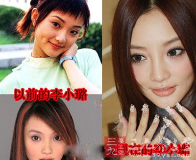 李小璐明显整容了眼睛和鼻子,鼻子变高的不自然 好像狮子的鼻子,有些