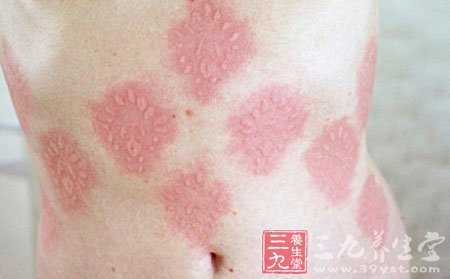 盘点稀奇古怪的15种恐惧症