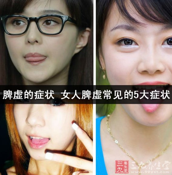 脾虚的症状 女人脾虚常见的5大症状 - 三九养生堂