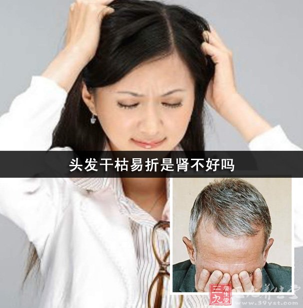 <em>头发干枯</em>易折是<em>肾</em>不好吗-三九养生堂