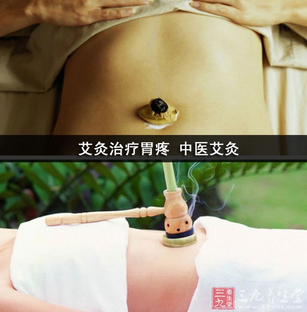 艾灸治疗胃疼 中医艾灸