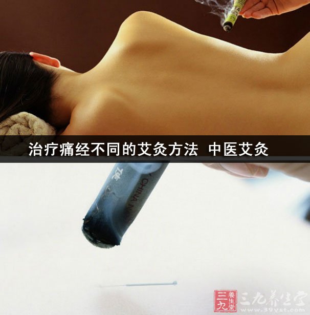 治疗痛经不同的艾灸方法 中医艾灸