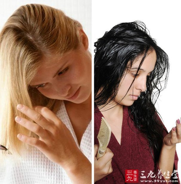 脱发怎么办减肥可导致脱发?-潍坊传媒网 潍坊