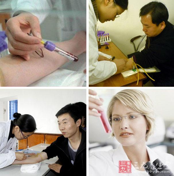 公务员体检 你知道哪些具体检查项目及标准