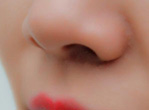 自体脂肪填充鼻唇沟 常抠鼻子有损健康