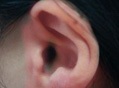 防治耳鸣需怎么做