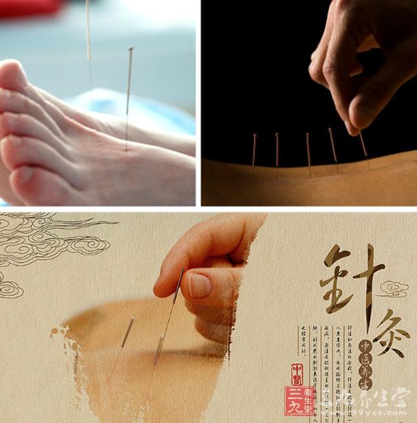 治疗脱发的最好方法 中医治疗脱发绝对赞 - 三