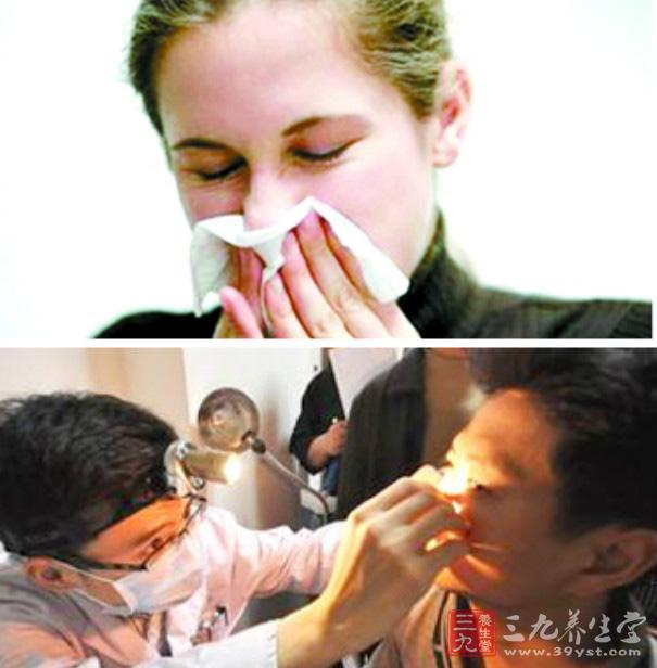 鼻息肉的治疗 一清二除三复查治愈鼻息肉(2)