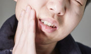牙周炎的病因是什么