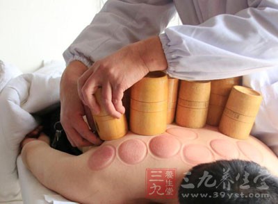 火罐还可以用在人体穴位上