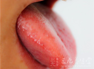 舌裂说明处于长期的脾肾功能弱小的状态