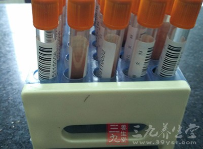 糖尿病干细胞移植 干细胞移植有哪些特点(2)