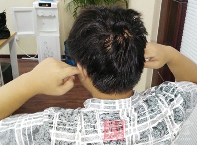 有残余听力的耳聋患者，在药物或手术治疗无效