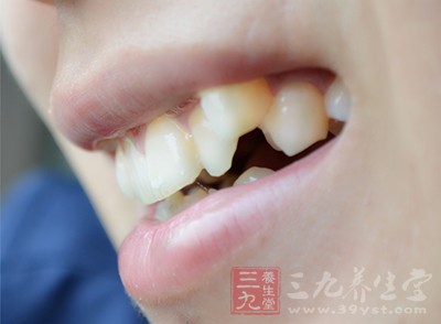 牙龈出血 女人这个小洞出血一定要当心