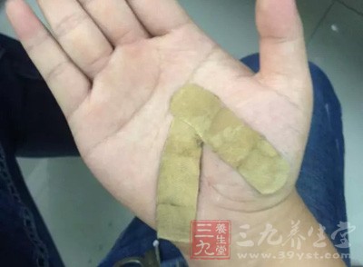 如何正確使用創(chuàng)口貼