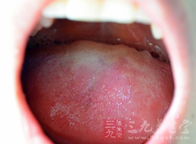 龋齿的危害 身上长出这些小黑点当心满是细菌
