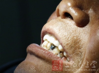 牙疼怎么办 牙疼不治竟会出现惊人变化