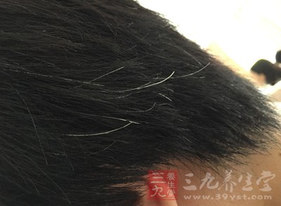如何让白头发消失 如何让白头发消失