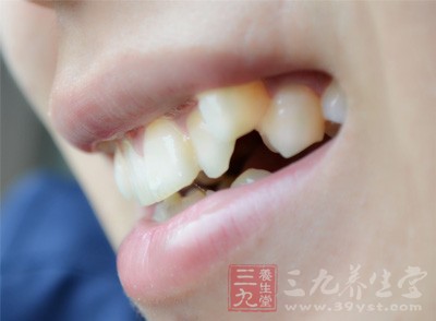氟斑牙的形成 牙齿上出现小白点竟暗示这事