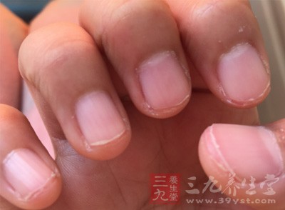 如果非要说指甲小月牙(指甲半月痕)与健康有关系的话,那么也仅限于万物均有联系的层面 如果非要说指甲小月牙(指甲半月痕)与健康有关系的话,那么也仅限于万物均有联系的层面