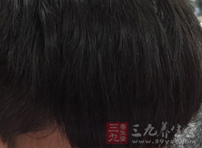 生理压力，比如生活中的各种创伤都会让毛囊收到突然的刺激