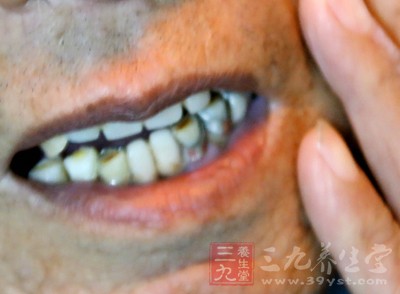 牙疼虽然听起来让人感受不到什么压力