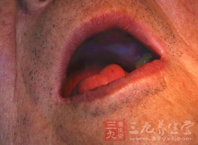 有过牙疼经验的朋友肯定能够体会牙疼给人带来的痛苦的折磨