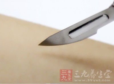 膀胱里长出这么大的石头实属罕见