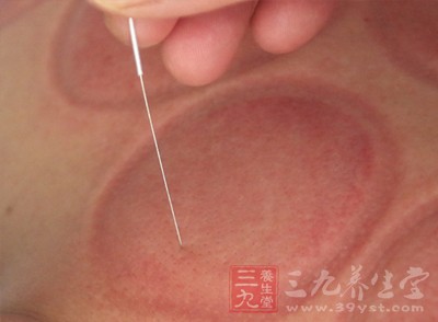 关元穴是人体要穴