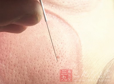 所以男人们在生活中想要让肾脏更加年轻