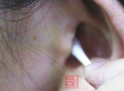 耳垢因种族而异