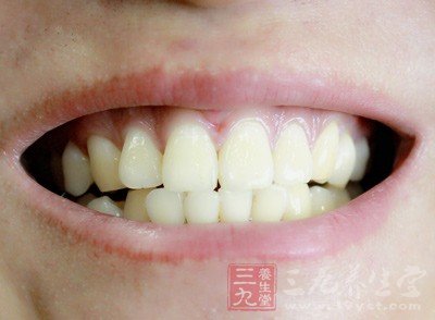 门牙缝大矫正 牙齿缝隙大的矫正方法