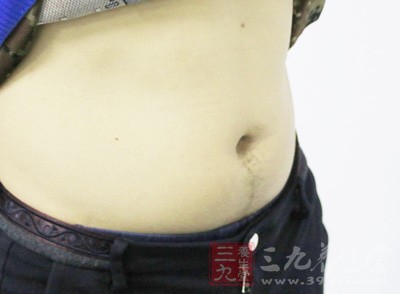 不吃早饭易患脂肪肝有道理吗 不吃早饭易患脂肪肝有道理吗